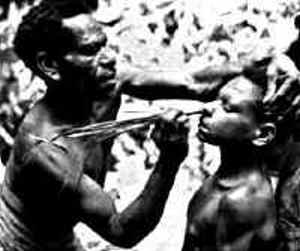 Sambia man puts bamboo reeds up boy's nose